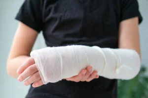 A person with their arm in a cast after an accident.