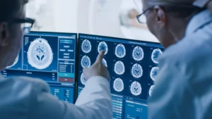 Delayed Concussion Symptoms